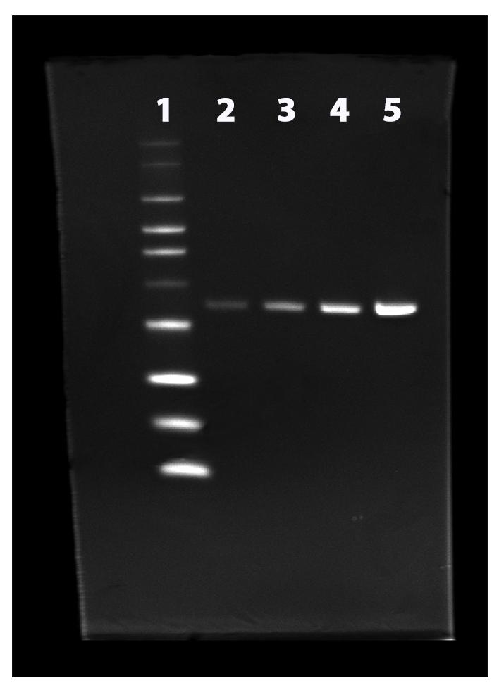 Two-fold dilution series of&nbsp;His-tagged annexin V were separated on a NuPAGE&reg; 4&ndash;12% Bis-Tris gel and stained with the ProLite&trade; His-Tag Protein Gel Staining Kit according to standard protocols. <strong>Lane 1:</strong> His-tagged protein ladder, <strong>Lane 2 to 5:</strong>&nbsp;two-fold dilution of His-tagged annexin V.