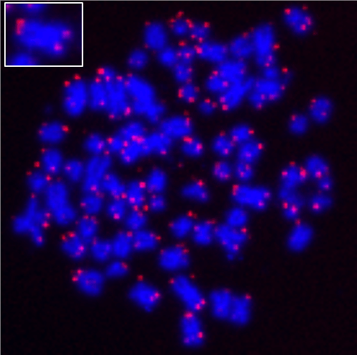 Telomere quantitative fluorescence in situ hybridization