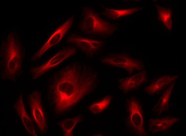 Immunofluorescence&nbsp;staining of tubulin in HeLa cells. HeLa cells were fixed with 4% PFA, permeabilized with 0.1% Triton X-100 and blocked. Cells were then incubated with mouse anti-tubulin monoclonal antibody and stained with a goat anti-mouse IgG labeled using the ReadiLink&trade; xtra Rapid AF647 Antibody Labeling Kit (Cat No. 1985).