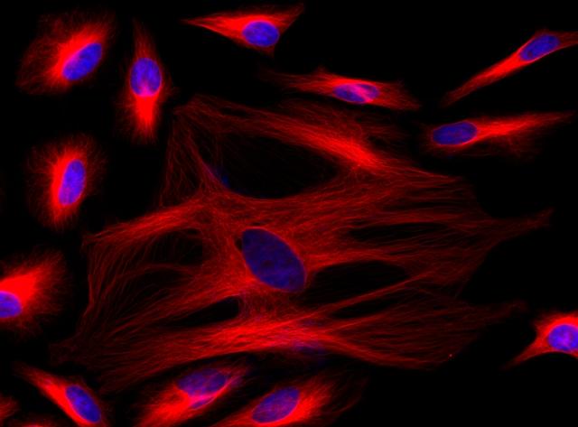 Immunofluorescence&nbsp;staining of tubulin in HeLa cells. HeLa cells were fixed with 4% PFA, permeabilized with 0.1% Triton X-100 and blocked. Cells were then incubated with mouse anti-tubulin monoclonal antibody and stained with a goat anti-mouse IgG labeled using the ReadiLink&trade; xtra Rapid Cy5 Antibody Labeling Kit (Cat No. 1972). The cell nuclei were counterstained using DAPI (Cat No. 17507).