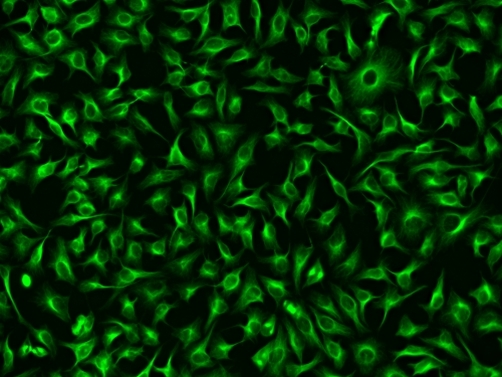 Immunofluorescence staining of tubulin in HeLa cells. HeLa cells were fixed with 4% PFA, permeabilized with 0.1% Triton X-100 and blocked. Cells were then incubated with rabbit anti-tubulin monoclonal antibody and stained with a goat anti-rabbit IgG labeled using the ReadiLink™ xtra Rapid FITC Antibody Labeling Kit (Cat No. 1970).