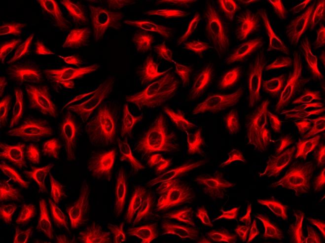Immunofluorescence staining of tubulin in HeLa cells. HeLa cells were fixed with 4% PFA, permeabilized with 0.1% Triton X-100 and blocked. Cells were then incubated with mouse anti-tubulin monoclonal antibody and stained with a goat anti-mouse IgG labeled using the ReadiLink™ xtra Rapid iFluor® 555 Antibody Labeling Kit (Cat No. 1958).