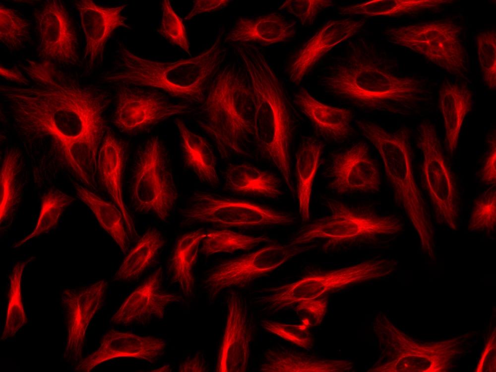 Immunofluorescence&nbsp;staining of tubulin in HeLa cells. HeLa cells were fixed with 4% PFA, permeabilized with 0.1% Triton X-100 and blocked. Cells were then incubated with mouse anti-tubulin monoclonal antibody and stained with a goat anti-mouse IgG labeled using the ReadiLink&trade; xtra Rapid iFluor® 594 Antibody Labeling Kit (Cat No. 1960).