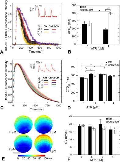 ATR effects on cardiomyocyte electrophysiology. (A) Action potentials in response to electrical pacing were imaged optically (using di4-ANBDQBS) and presented as mean ± SEM at each point for each group. (B) Quantified APD80 for control CM and ChR2-CM without ATR and with 1 μM ATR (highest optical excitability). Both A and B had n = 3–4 samples per experimental group. (C) Calcium transients in response to electrical pacing were imaged optically (using Rhod4-AM) and presented as mean ± SEM at each point for each group. (D) Quantified CTD80 for control CM and ChR2-CM at different ATR supplements. Both C and D had n = 7–33 samples for each of the eight experimental groups. (E) Example activation maps of ChR2-CM, following point electrical stimulation at the bottom; isochrones are 10 ms apart. Scale bar is 5 mm. (F) Quantified conduction velocity from the activation maps (n = 7–14 per group). (*) indicates significant difference at p < 0.05 compared to the respective control (zero ATR) or as indicated by the brackets. Source: <strong>Cardiac Optogenetics: Enhancement by All-trans-Retinal </strong>by Yu et al., <em>Scientific Reports</em>, Nov. 2016.