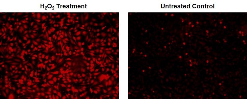Fluorescence images of ROS measurement in HeLa cells using ROS Brite™ DHCF (Cat# 16053). H<sub>2</sub>O<sub>2</sub> Treatment: Cells were incubated with ROS Brite™ DHCF for 1 hour, then treated with 1 mM H<sub>2</sub>O<sub>2</sub> at 37 °C for 30 minutes. Untreated Control: HeLa cells were incubated with ROS Brite™ DHCF at 37 °C for 1 hour without H<sub>2</sub>O<sub>2</sub> treatment. The fluorescence signal was measured using fluorescence microscope with a TRITC filter.