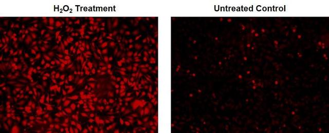 Fluorescence images of ROS measurement in HeLa cells using ROS Brite&trade; DHCF (Cat# 16053). H<sub>2</sub>O<sub>2</sub> Treatment: Cells were incubated with ROS Brite&trade; DHCF for 1 hour, then treated with 1 mM H<sub>2</sub>O<sub>2</sub> at 37 &deg;C for 30 minutes. Untreated Control: HeLa cells were incubated with ROS Brite&trade; DHCF at 37 &deg;C for 1 hour without H<sub>2</sub>O<sub>2</sub> treatment. The fluorescence signal was measured using fluorescence microscope with a TRITC filter.