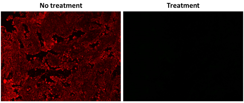 Formalin-fixed, paraffin-embedded (FFPE) human lung tissue sections were immunolabeled with CD4-XFD488 mAb, followed by incubation with HRP-conjugated goat anti-XFD488 IgG. To inhibit HRP enzymatic activity, sections were treated with Signal Guard™ 10X Rapid HRP Reaction Stopping Solution. Fluorescence was then developed using iFluor® 647 styramide (Cat. 45045) and visualized using a Cy5 filter set. Tissue sections pre-treated with Signal Guard™ prior to styramide application exhibited no detectable signal (Right), in contrast to untreated sections (Left), demonstrating effective inhibition of HRP activity by the stopping solution.