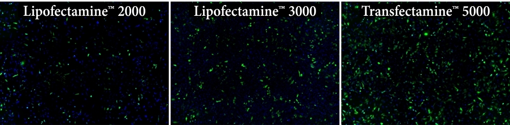 Transfection efficiency comparison in HeLa cells using Transfectamine™ 5000, Lipofectamine 2000 and Lipofectamine 3000 reagents. Each reagent was used to transfect HeLa cells in a 96-well format, and GFP expression was analyzed 24 hours post-transfection. Transfectamine™ 5000 transfection reagent provided higher GFP transfection efficiency compared to Lipofectamine 2000 and Lipofectamine 3000 reagents.
