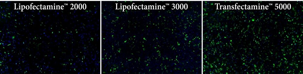 Transfection efficiency comparison in HeLa cells using Transfectamine&trade; 5000, Lipofectamine 2000 and Lipofectamine 3000 reagents. Each reagent was used to transfect HeLa cells in a 96-well format, and GFP expression was analyzed 24 hours post-transfection. Transfectamine&trade; 5000 transfection reagent provided higher GFP transfection efficiency compared to Lipofectamine 2000 and Lipofectamine 3000 reagents.