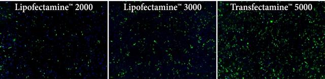 Transfection efficiency comparison in HeLa cells using Transfectamine&trade; 5000, Lipofectamine 2000 and Lipofectamine 3000 reagents. Each reagent was used to transfect HeLa cells in a 96-well format, and GFP expression was analyzed 24 hours post-transfection. Transfectamine&trade; 5000 transfection reagent provided higher GFP transfection efficiency compared to Lipofectamine 2000 and Lipofectamine 3000 reagents.