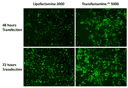 Transfection efficiency comparison of Transfectamine™ 5000 versus Lipofectamine 2000 reagents for CRISPR-Cas9-GFP plasmid in HeLa cells. Each reagent was used to transfect HeLa cells in a 96-well format, and the GFP expression was analyzed after 48 and 72 hours post-transfection. Transfectamine™ 5000 transfection reagent provided higher GFP transfection efficiency compared to Lipofectamine 2000.