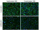 HeLa cells were subjected to immunohistochemistry after transfecting with control siRNA or GAPDH siRNA using Lipofectamine 2000 and Transfectamine™ 7000. The experiment aimed to compare the efficacy of both transfection methods in knocking down GAPDH. After 48 hours of transfection, GAPDH was detected using an iFluor® 488 goat anti-mouse IgG (Cat No. 16528) through immunohistochemistry.