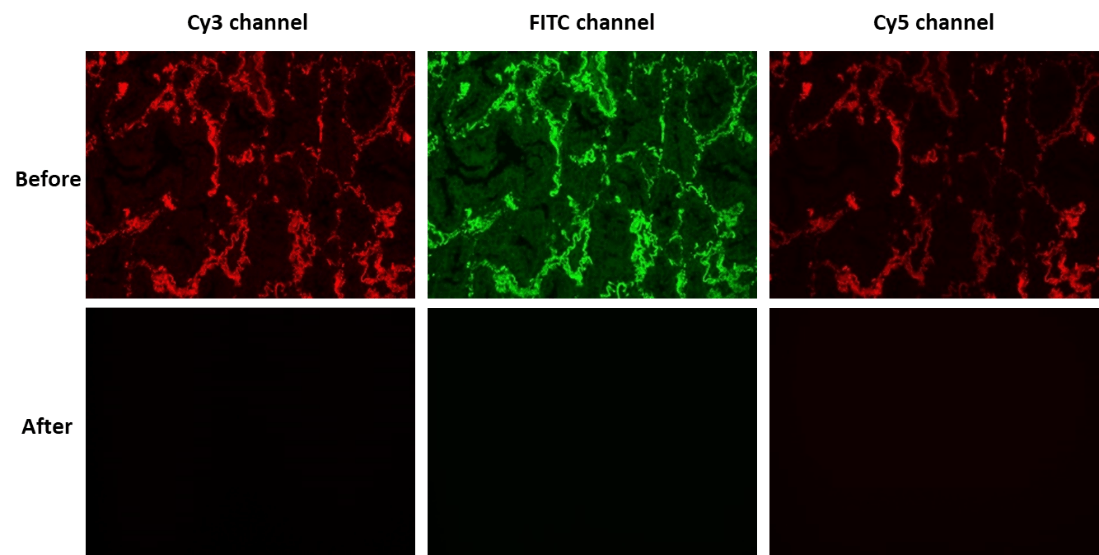 XAF Black™ Lipofuscin Autofluorescence Blocker effectively minimizes non-lipofuscin autofluorescence in human lung adenocarcinoma tissue sections across FITC, Cy®3, and Cy®5 channels. Autofluorescence was imaged using a fluorescence microscope with identical imaging parameters for both untreated and treated samples. The top panel displays tissue sections prior to treatment, while the bottom panel shows the same sections following treatment.