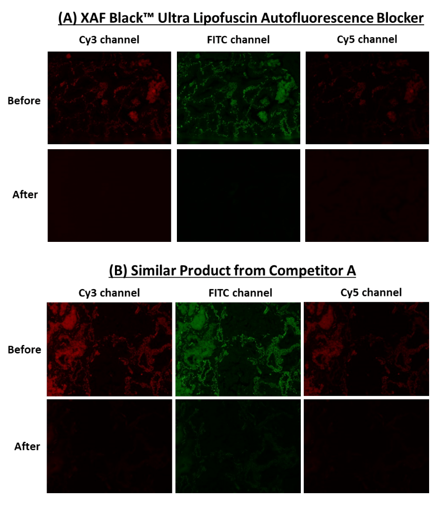 XAF Black™ Ultra Lipofuscin Autofluorescence Blocker effectively diminishes non-lipofuscin autofluorescence in human lung adenocarcinoma tissue sections across the FITC, Cy®3, and Cy®5 fluorescence channels. Imaging was performed using consistent microscope settings across all channels for both control (untreated) and treated tissue sections. Top panel: Pre-treatment; Bottom panel: Post-treatment.