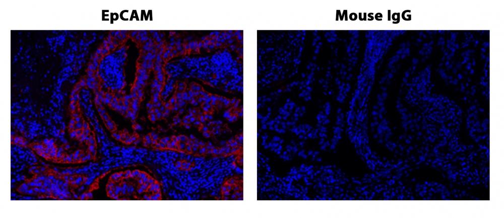 Fluorescence IHC of formaldehyde-fixed, paraffin-embedded human lung adenocarcinoma positive tissue using PSA<strong>&nbsp;&trade;</strong>&nbsp;amplified methods. Human lung adenocarcinoma positive tissue sections were stained with&nbsp;Mouse anti-EpCAM or Control Mouse IgG antibody and then incubated with polyHRP-labeled Goat anti-Mouse IgG secondary antibody followed by&nbsp;XFD 532 tyramide (Cat#11072).