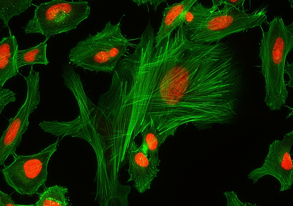 <strong>Fixed and stained HeLa cells.</strong><br>HeLa cells were fixed with 4% formaldehyde, permeabilized, and blocked. F-actin were stained with XFD488 phalloidin (Cat No. 23153) and nuclei labeled with Nuclear Red™ DCS1 (Cat No. 17552). Images were acquired on a Keyence BZ-X710 all-in-one fluorescence microscope.