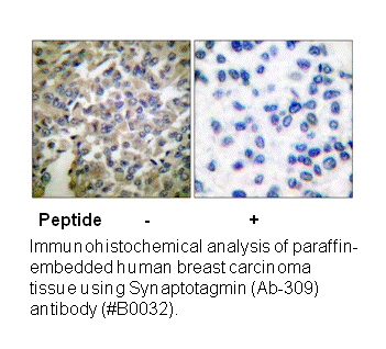 Product image for Synaptotagmin (Ab-309) Antibody
