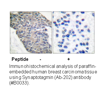 Product image for Synaptotagmin (Ab-202) Antibody
