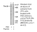 Product image for Trk B (Ab-515) Antibody