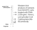 Product image for Acetyl-CoA Carboxylase (Ab-80) Antibody