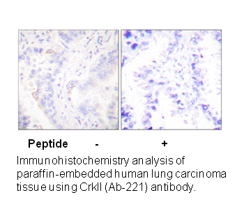 Product image for CrkII (Ab-221) Antibody
