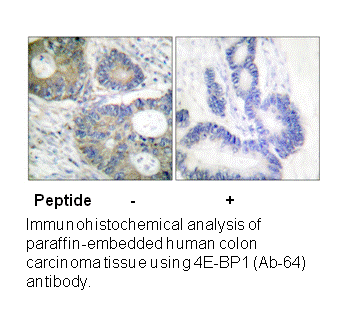 Product image for 4E-BP1 (Ab-64) Antibody