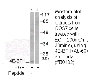 Product image for 4E-BP1 (Ab-69) Antibody