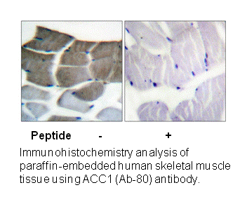 Product image for ACC1 (Ab-80) Antibody