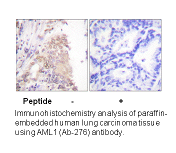 Product image for AML1 (Ab-276) Antibody