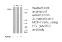 Product image for HSL (Ab-552) Antibody