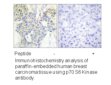 Product image for p70 S6 Kinase (Ab-389) Antibody