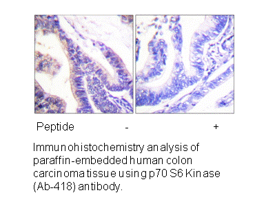 Product image for p70 S6 Kinase (Ab-418) Antibody