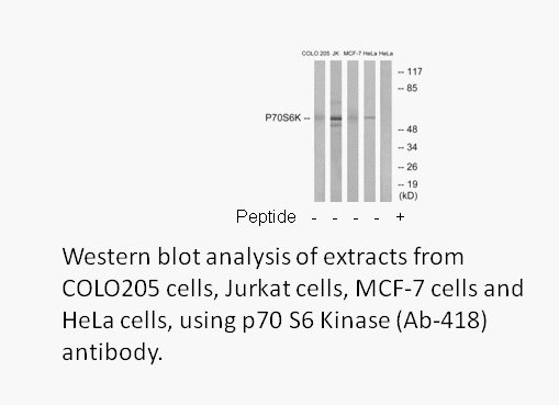 Product image for p70 S6 Kinase (Ab-418) Antibody