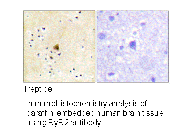 Product image for RyR2 (Ab-2808) Antibody