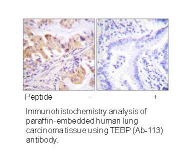 Product image for TEBP (Ab-113) Antibody