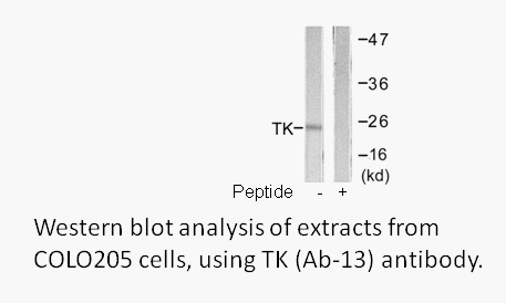 Product image for TK (Ab-13) Antibody