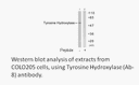 Product image for Tyrosine Hydroxylase (Ab-8) Antibody