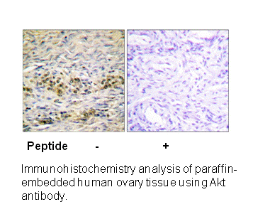 Product image for Akt (Ab-474) Antibody