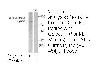 Product image for ATP-Citrate Lyase (Ab-454) Antibody