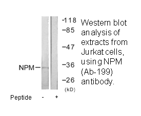 Product image for NPM (Ab-199) Antibody