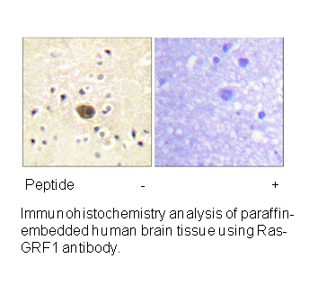 Product image for Ras-GRF1 (Ab-916) Antibody