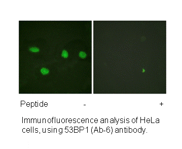 Product image for 53BP1 (Ab-6) Antibody