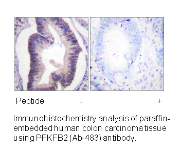 Product image for Fructose 6 Phosphate Kinase (Ab-483) Antibody