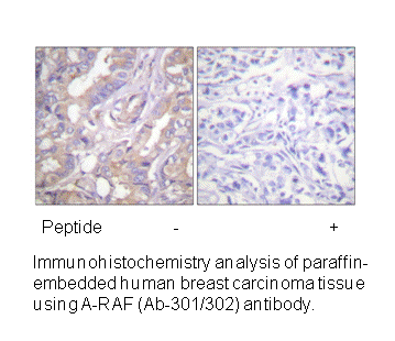 Product image for A-RAF (Ab-301/302) Antibody