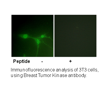 Product image for Breast Tumor Kinase (Ab-447) Antibody