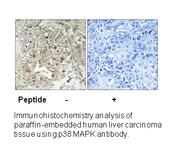 Product image for p38 MAPK (Ab-179/181) Antibody