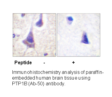 Product image for PTP1B (Ab-50) Antibody