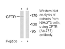 Product image for CFTR (Ab-737) Antibody