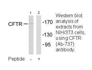 Product image for CFTR (Ab-737) Antibody
