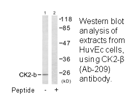 Product image for CKII-&beta; (Ab-209) Antibody